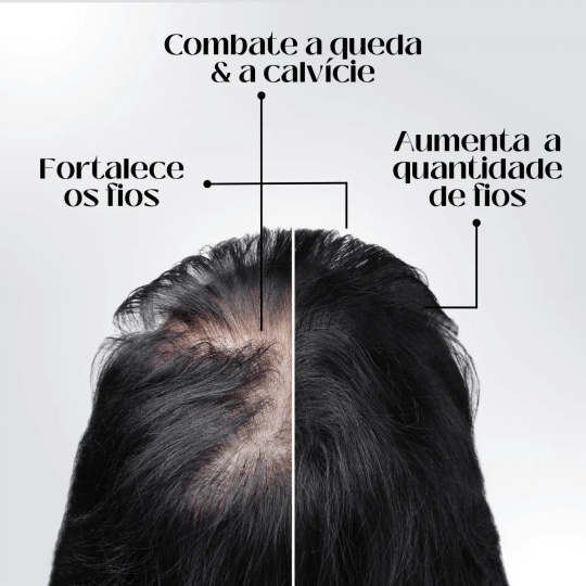 95%-os csökkenés csökkenés, 20x növekedés növekedés | Fix Your Hair®